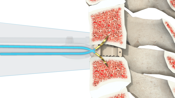 微信图片_2026-04-22_130937_495
